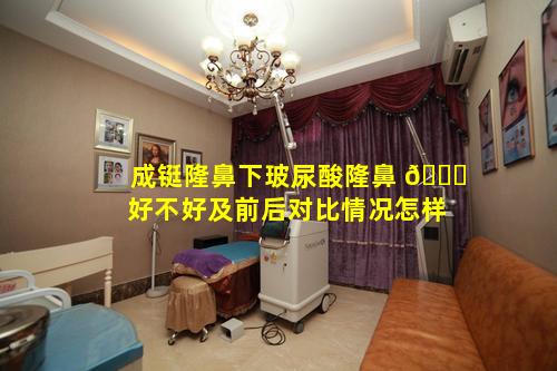 成铤隆鼻下玻尿酸隆鼻 🍁 好不好及前后对比情况怎样